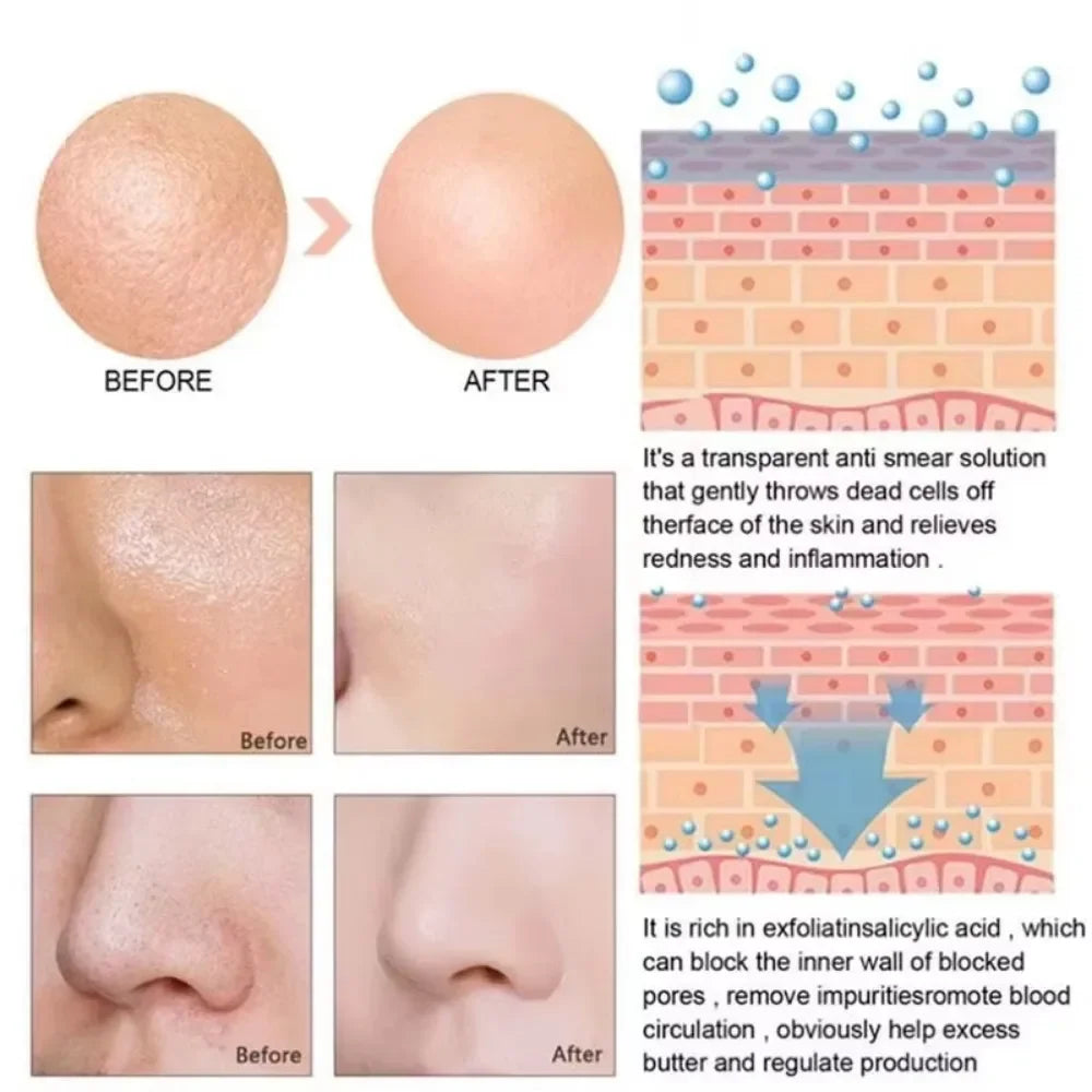 Sérum d'élimination des grands Pores, acide lactique, rétrécissement des pores, minimisant, Essence, hydratant, raffermissant, réparation lisse, soins coréens pour la peau