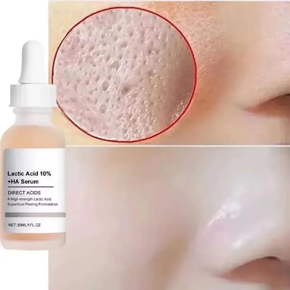 Sérum d'élimination des grands Pores, acide lactique, rétrécissement des pores, minimisant, Essence, hydratant, raffermissant, réparation lisse, soins coréens pour la peau