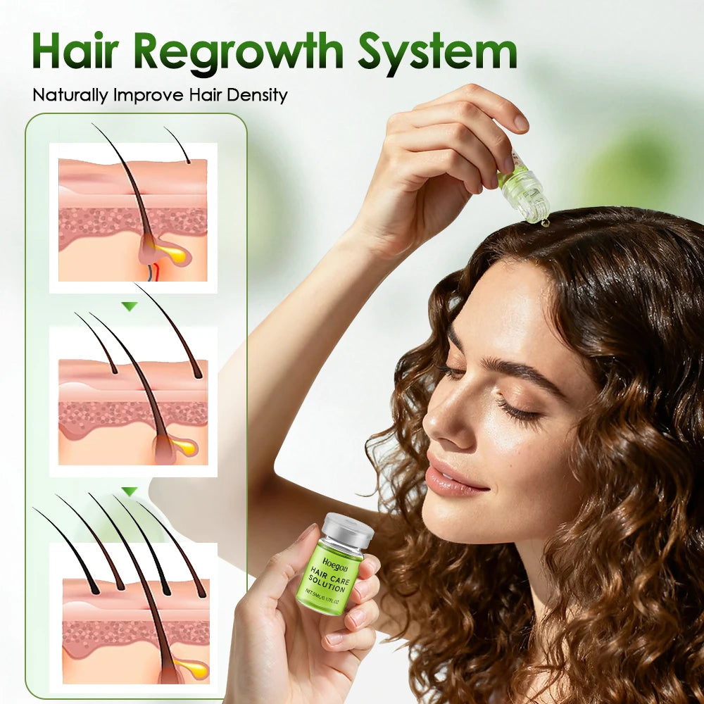 Sérum capillaire essentiel 1/2/3 boîtes pour renforcer les racines, réduire la chute, prévenir la calvitie, nourrir et favoriser la repousse des cheveux.