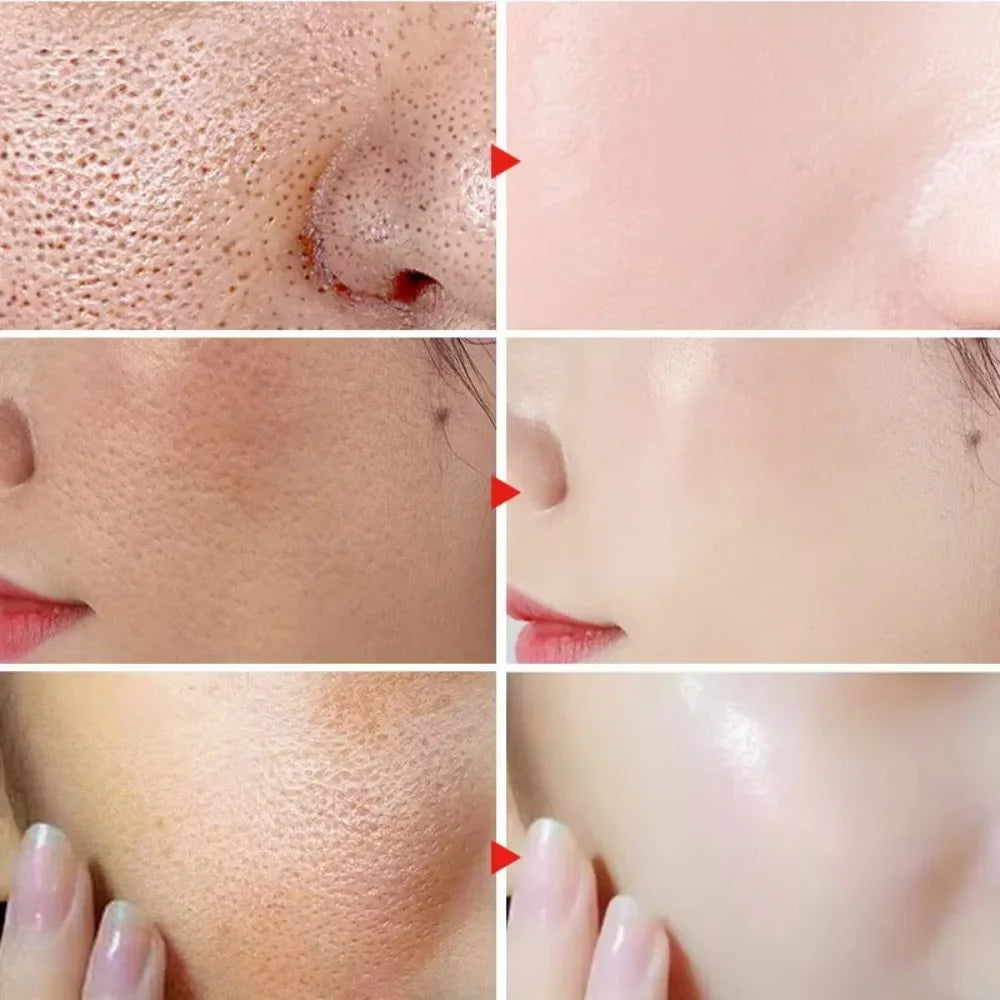 Sérum d'élimination des grands Pores, acide lactique, rétrécissement des pores, minimisant, Essence, hydratant, raffermissant, réparation lisse, soins coréens pour la peau