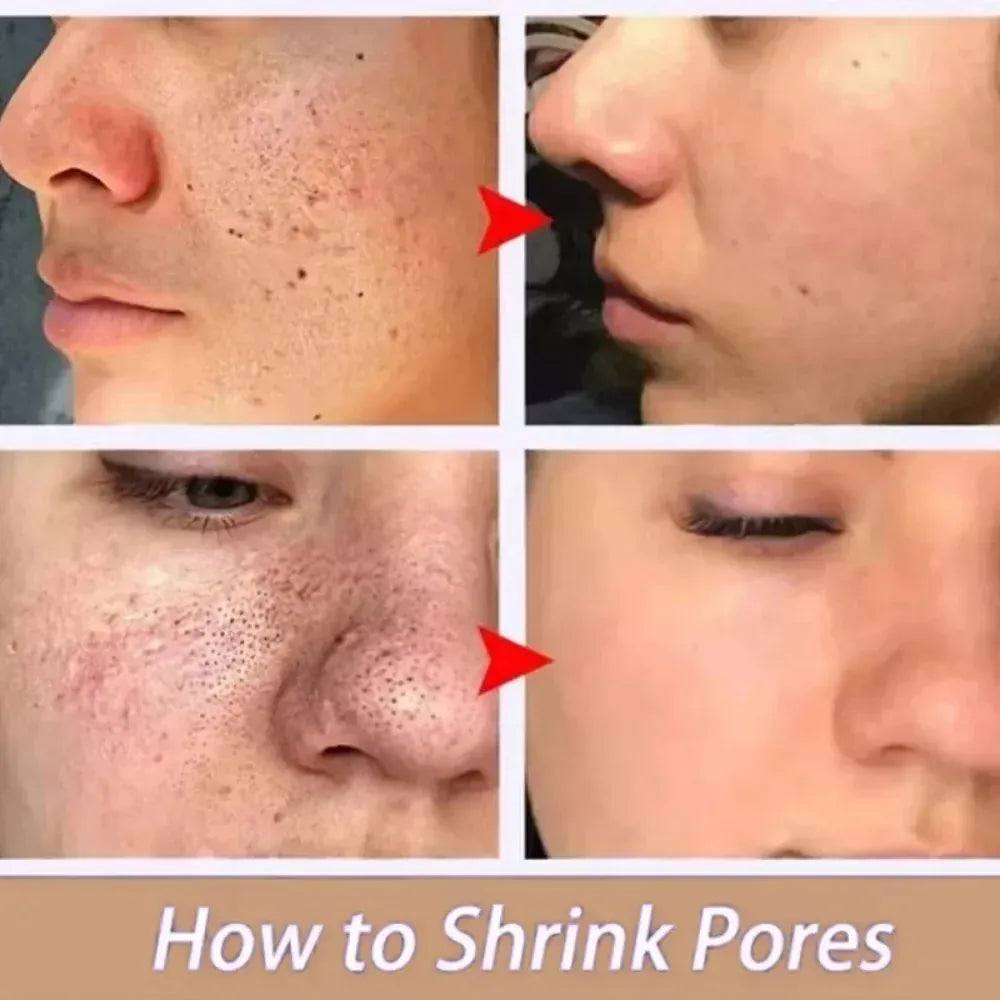 Sérum d'élimination des grands Pores, acide lactique, rétrécissement des pores, minimisant, Essence, hydratant, raffermissant, réparation lisse, soins coréens pour la peau