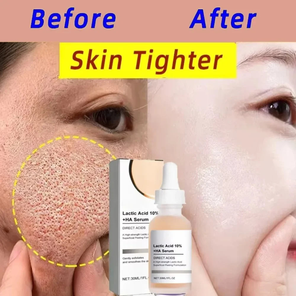 Sérum d'élimination des grands Pores, acide lactique, rétrécissement des pores, minimisant, Essence, hydratant, raffermissant, réparation lisse, soins coréens pour la peau